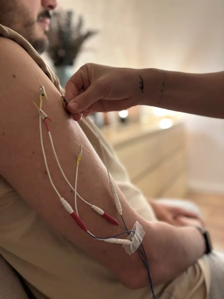 Terapeuta ajustando electrodos en sesión de electroacupuntura personalizada